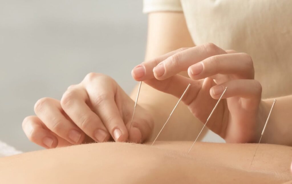 Especialista Acupuntura
