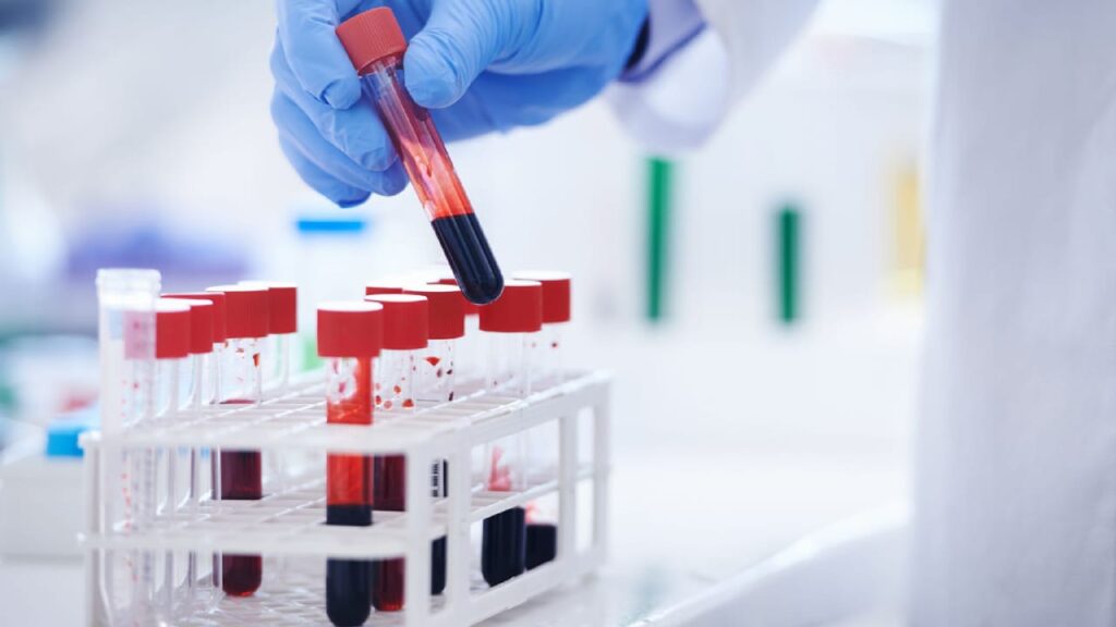 Exámenes de Laboratorio